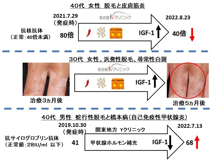 円形脱毛症　病院